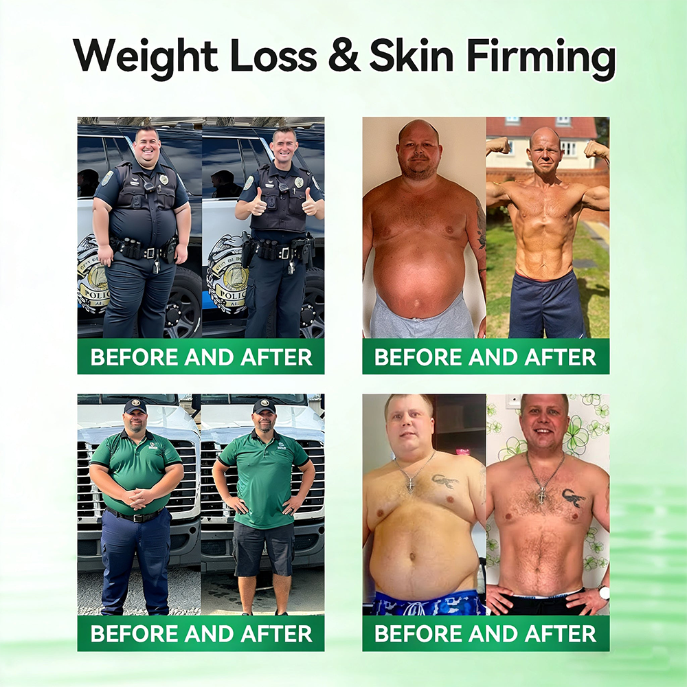 🇺🇸𝑶𝒇𝒇𝒊𝒄𝒊𝒂𝒍 𝑺𝒕𝒐𝒓𝒆  | 🗽 𝐇𝐞𝐚𝐥𝐫𝐢𝐳𝐞® 𝙈𝒐𝒓𝒊𝒏𝒈𝗮 · 𝗕𝗲𝗿𝗯𝐞𝐫𝐢𝐧𝙚 × 𝙉𝑨𝑫+ 𝟏𝟎-𝙞𝙣-𝟏 𝘼𝒅𝒗𝒂𝒏𝒄𝒆𝐝 𝐍𝐚𝐧𝙤 𝙈𝙞𝙘𝙧𝙤𝙣𝒆𝒆𝒅𝒍𝐞 𝐏𝐚𝐭𝙘𝙝(𝐉𝐮𝐬𝐭 𝐨𝐧𝐜𝐞 𝐚 𝐝𝐚𝐲, 𝐯𝐢𝐬𝐢𝐛𝐥𝐞 𝐜𝐡𝐚𝐧𝐠𝐞𝐬 𝐢𝐧 𝟕 𝐝𝐚𝐲𝐬） ✅ 𝐅𝐨𝐫 𝐨𝐛𝐞𝐬𝐢𝐭𝐲, 🅛🅞🅞🅢🅔 🅢🅚🅘🅝,𝐝𝐢𝐚𝐛𝐞𝐭𝐞𝐬, 𝐬𝐥𝐞𝐞𝐩 𝐚𝐩𝐧𝐞𝐚, 𝐣𝐨𝐢𝐧𝐭 𝐢𝐬𝐬𝐮𝐞𝐬, 𝐚𝐧𝐝 𝐦𝐨𝐫𝐞.